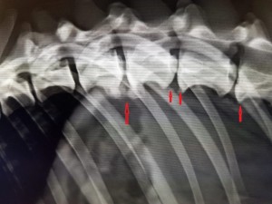 Spondylose piler